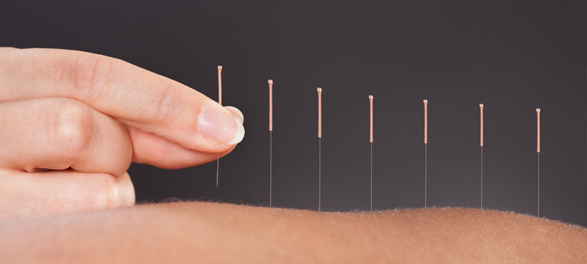 How far do the needles go in for acupuncture?