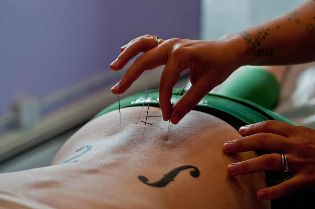 Lierre Acupuncture, photo by Marnie Joyce