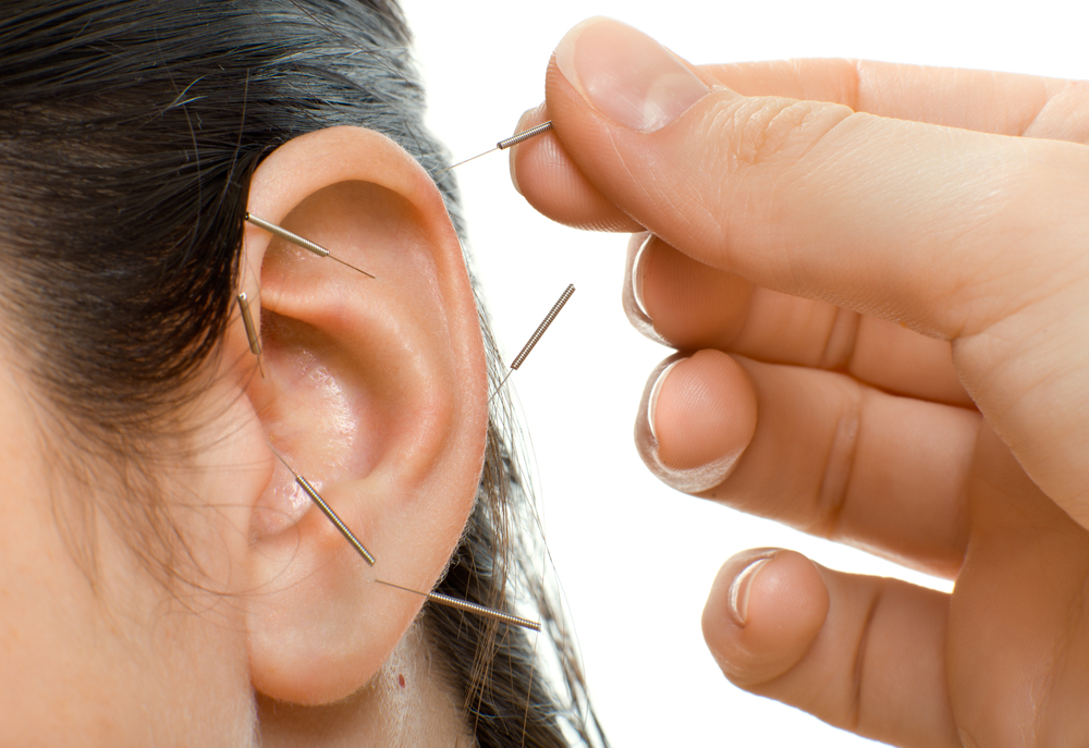 Ear-Acupuncture