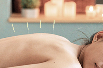 Where do you put acupuncture needles?-lierre.ca