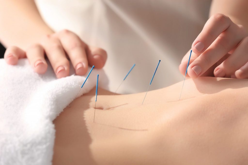 Fibromyalgia relief from acupuncture - Lierre.ca Canada