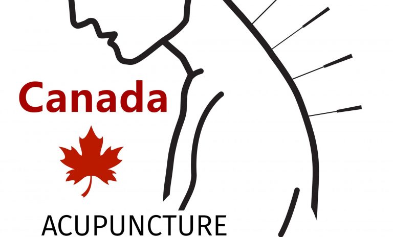 Where to Buy Acupuncture Needle Supplies in Vancouver