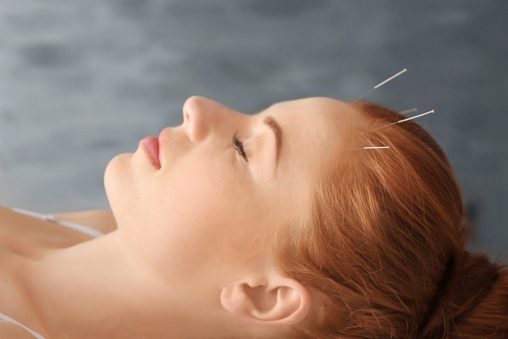 What kind of needles are used in acupuncture?