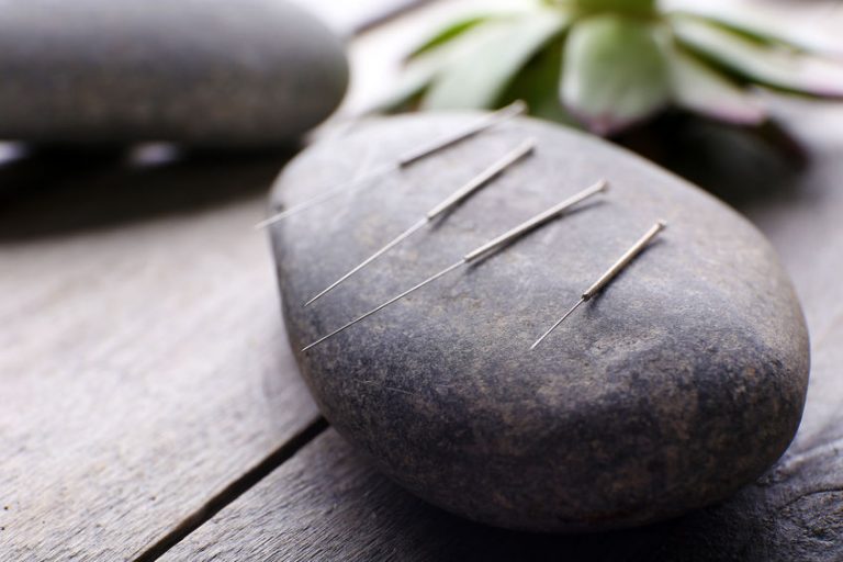 Things To Know Before Acupuncture Treatment