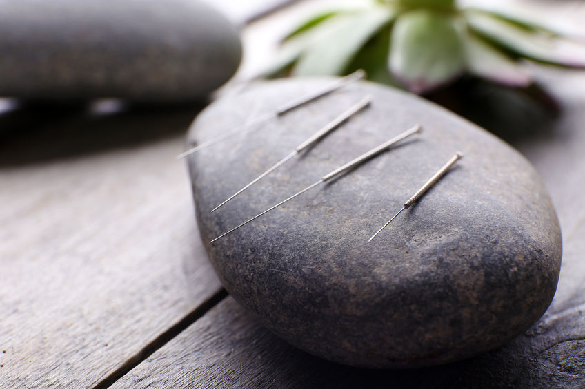 Show the size of acupuncture needles