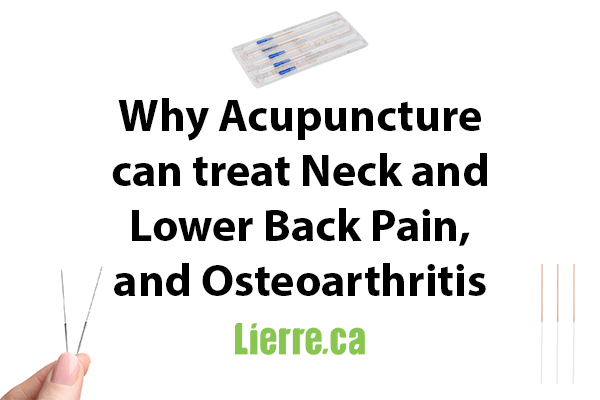 Acupuncture for neck and back, and osteoarthritis pain from Lierre.ca Canada