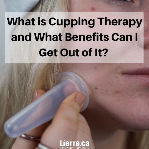 What is Cupping Therapy and What Benefits Can I Get Out of It?
