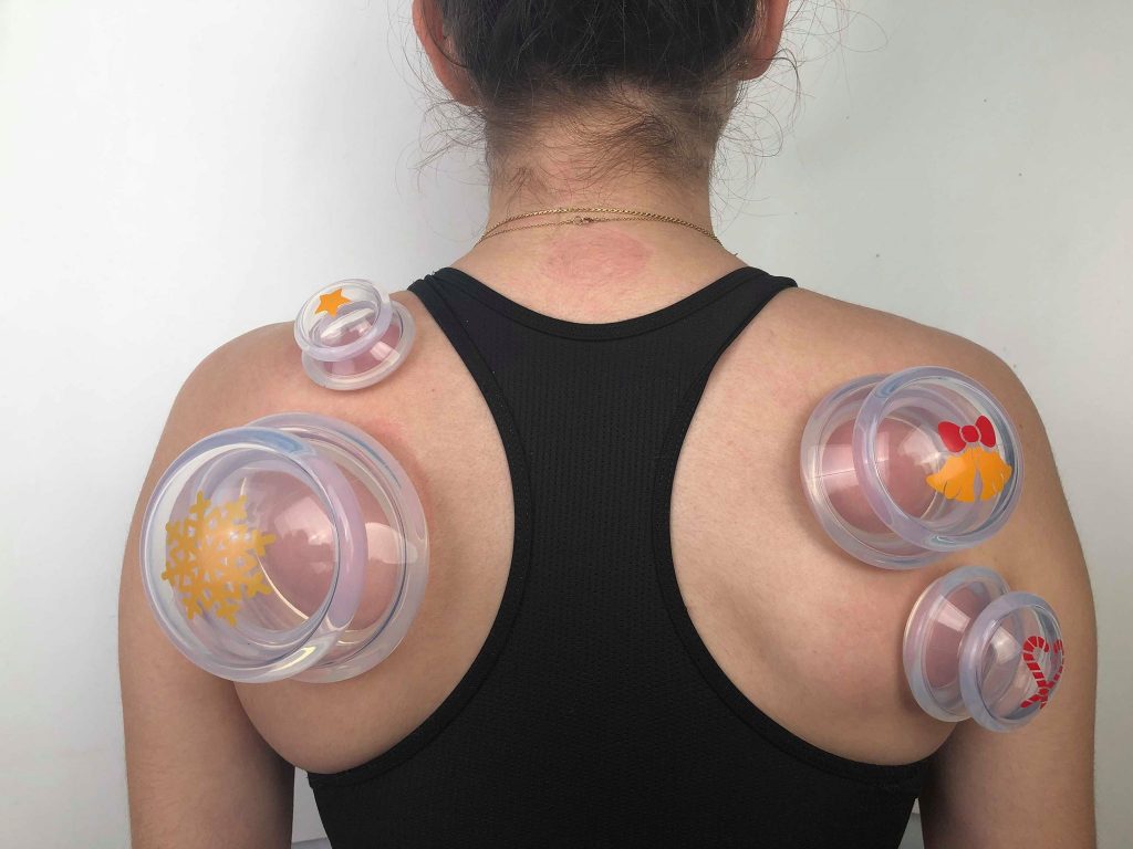 shop cupping therapy set from bursitis condition at lierre.ca 