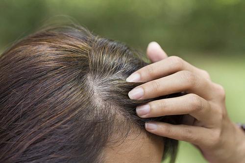 What causes your hair to fall out?
