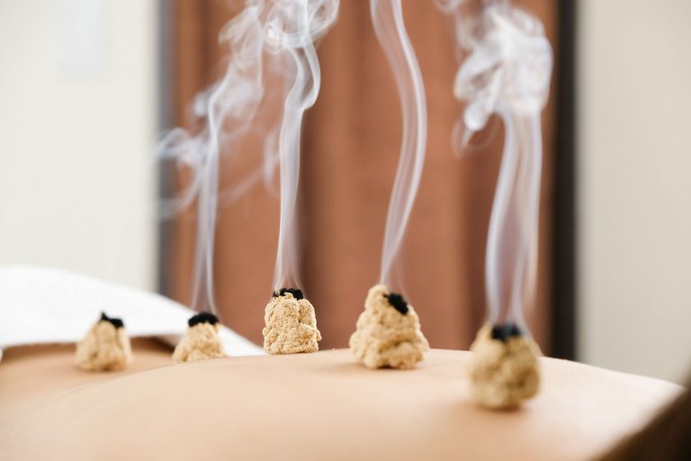 What is Moxibustion And How Do You Do It Safely?