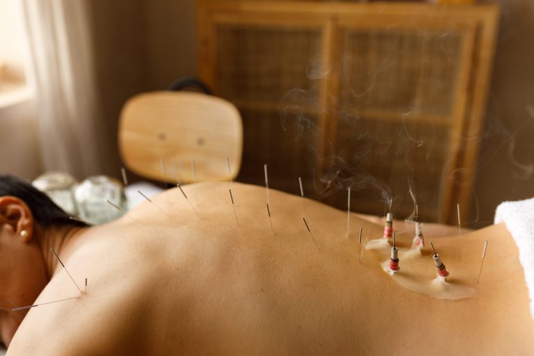 6 Tips On How To Open An Acupuncture Clinic And Grow Your Clientele