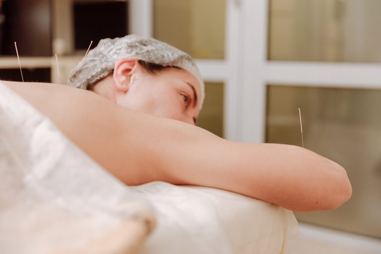 Why Do You Feel So Relaxed after You Get Acupuncture?